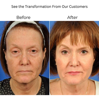 Collagen Renewal Eye Treatment