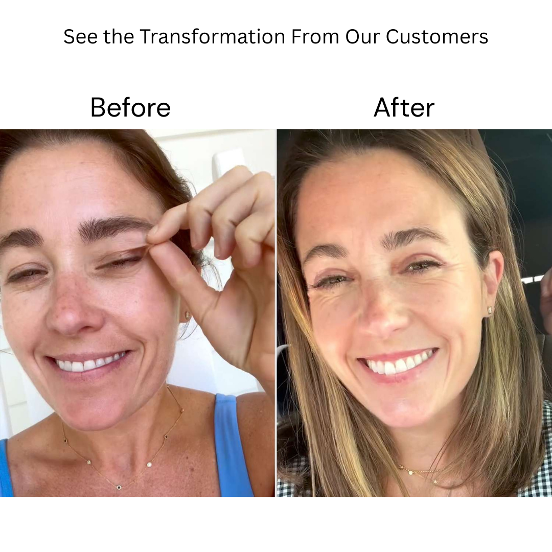 Collagen Renewal Eye Treatment