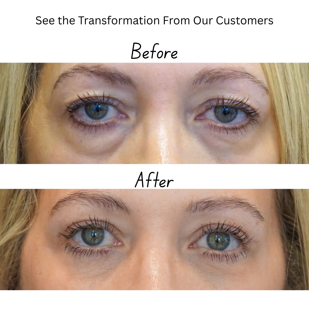 Collagen Renewal Eye Treatment