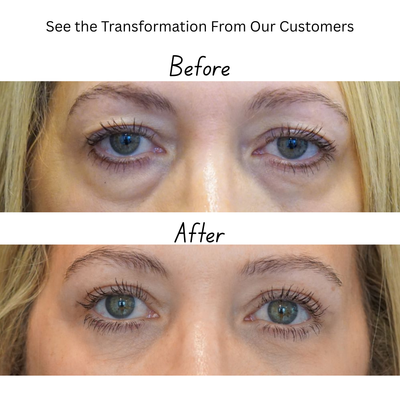Collagen Renewal Eye Treatment