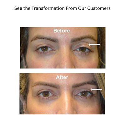 Collagen Renewal Eye Treatment