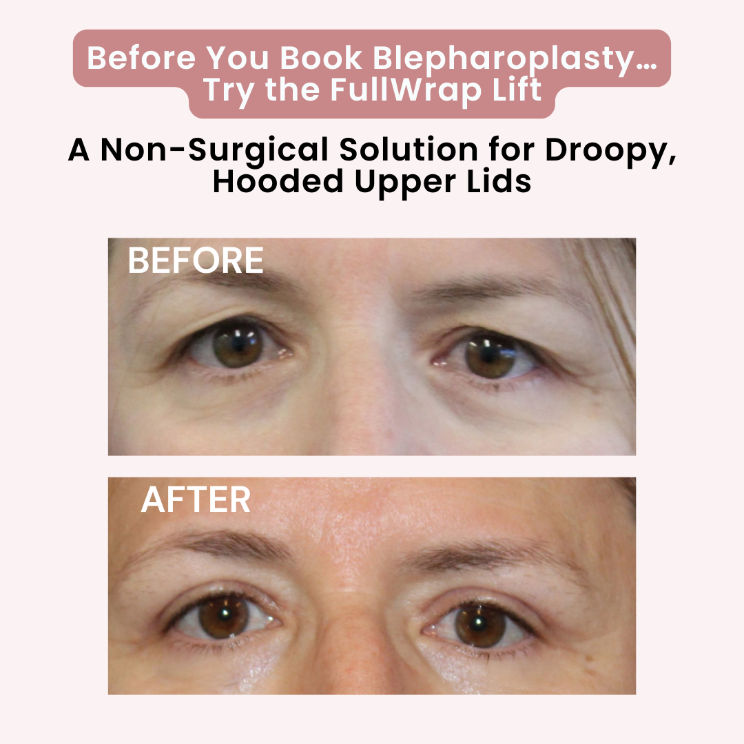 FullWrap Collagen Eye Mask