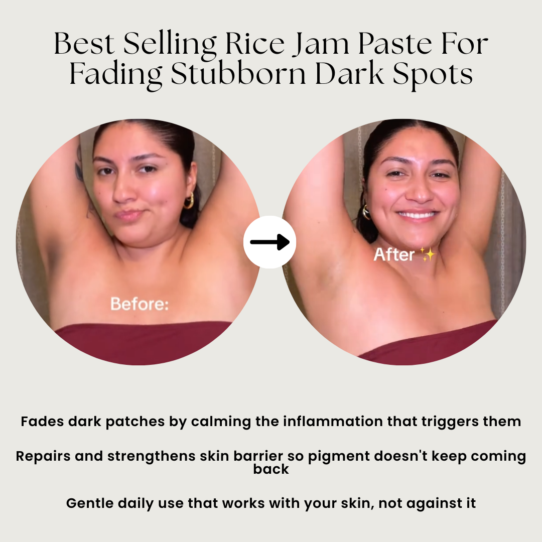 Dark Spots & Hyperpigmentation Correction Rice Jam Mask
