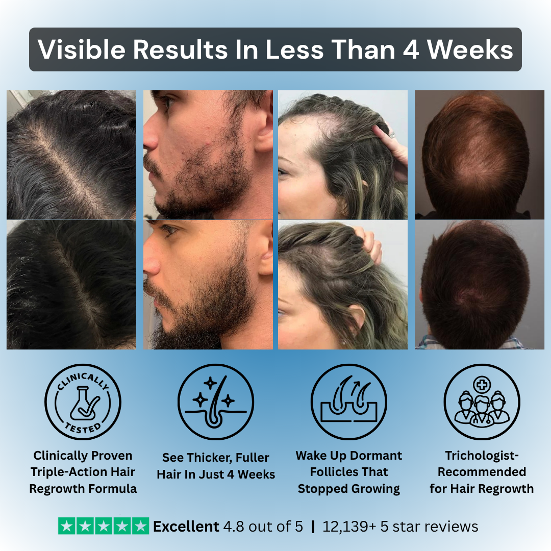 TriPhase Hair Regrowth Serum