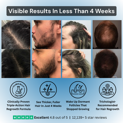 TriPhase Hair Regrowth Serum