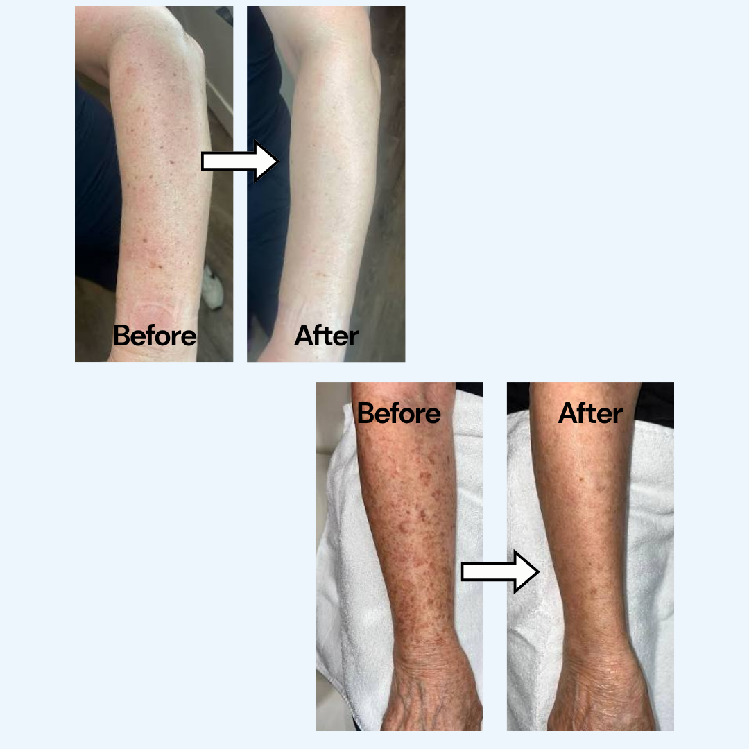 Pure TXA + Niacinamide Body Cream