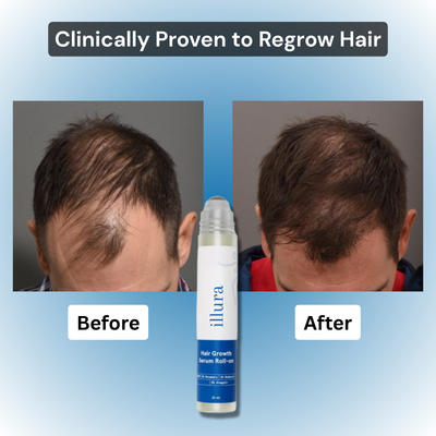 TriPhase Hair Regrowth Serum