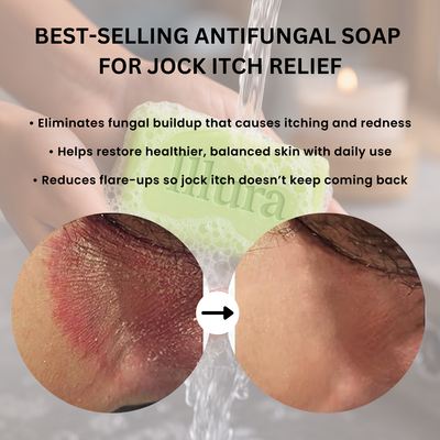 Tea Tree Oil Antifungal Soap Bar