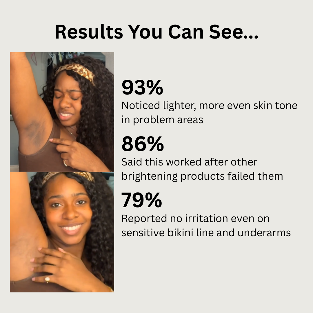 Dark Spots & Hyperpigmentation Correction Rice Jam Mask