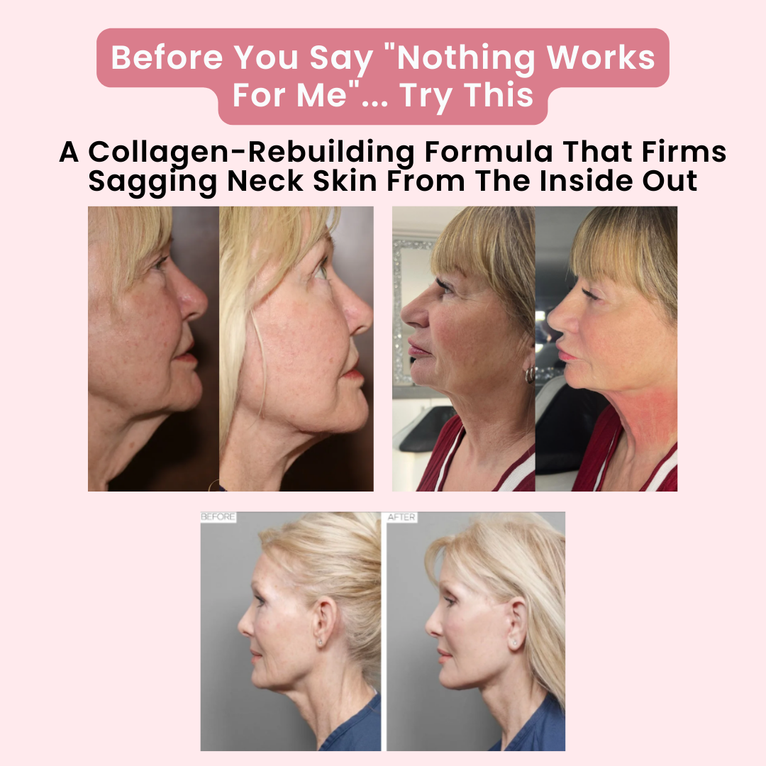 Deep Collagen Neck Lifting & Tightening Mask