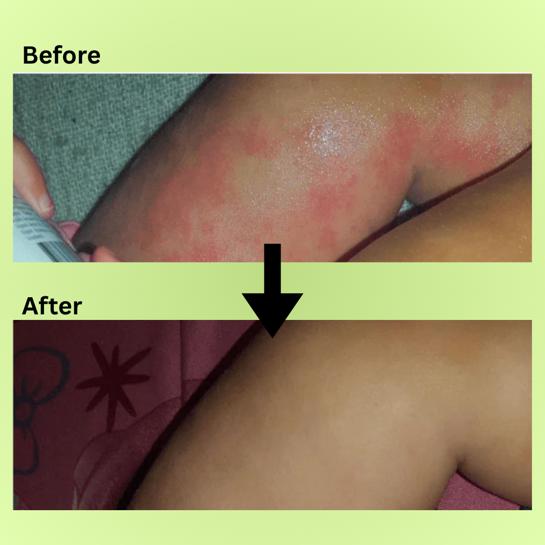 Tea Tree Oil Antifungal Soap Bar