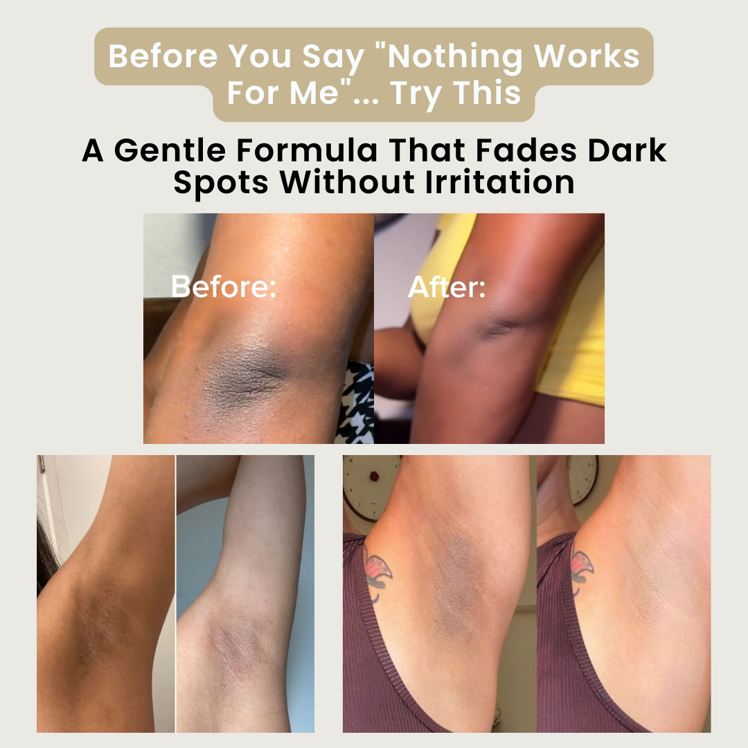 Dark Spots & Hyperpigmentation Correction Rice Jam Mask