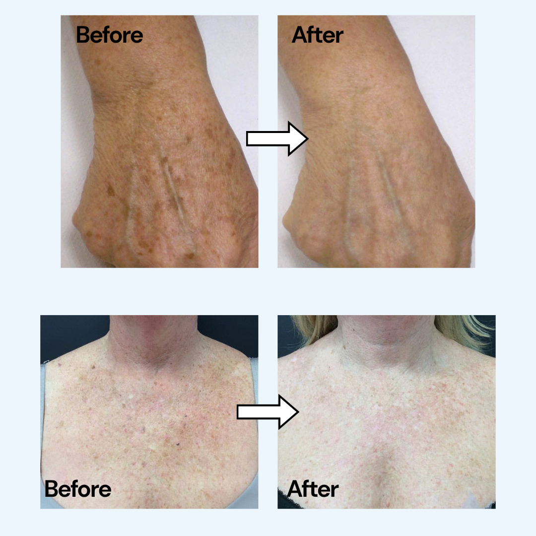 Pure TXA + Niacinamide Body Cream