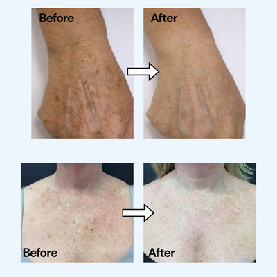 Pure TXA + Niacinamide Body Cream