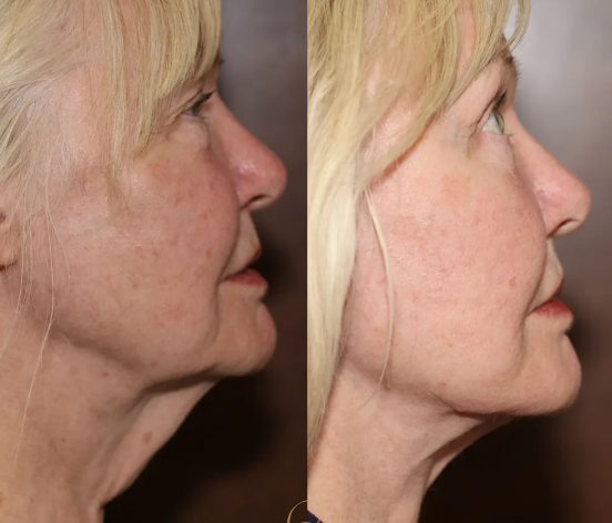 Review by Michelle K