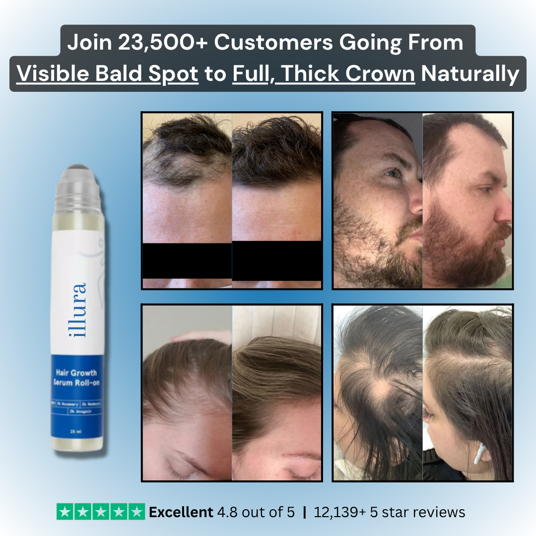 TriPhase Hair Regrowth Serum