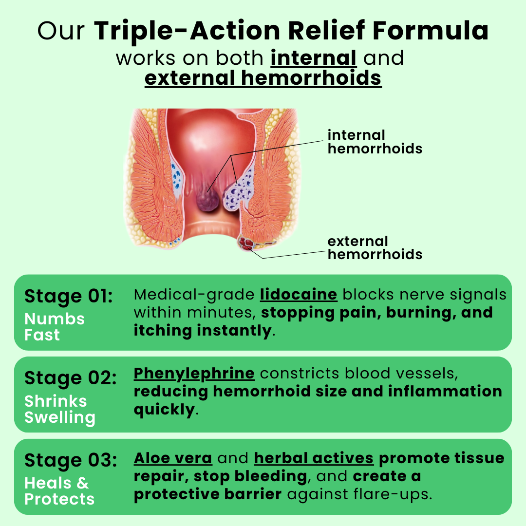 Advanced Hemorrhoid Relief Cream